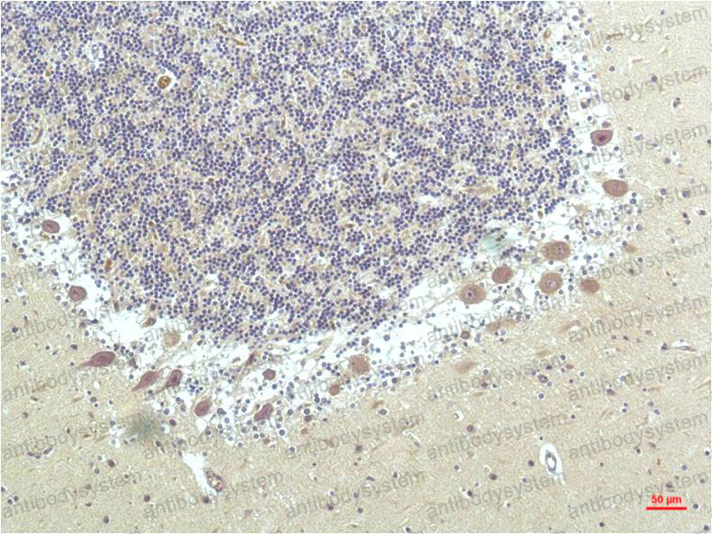 Anti-PPARD Antibody (R3Q79)