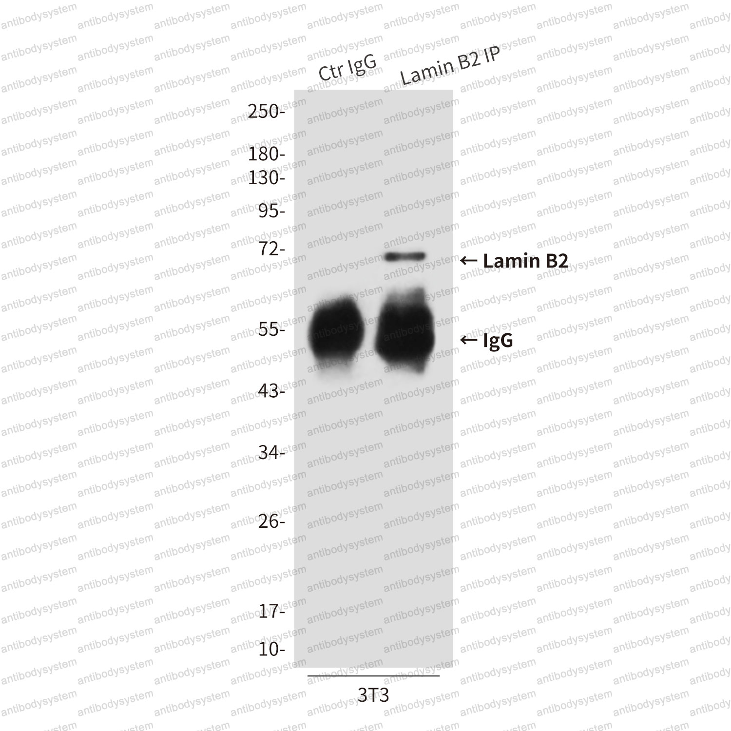 Anti-LMNB2 Antibody (R3Q81)