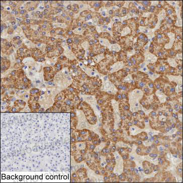 Anti-MVK Antibody (R3Q85)