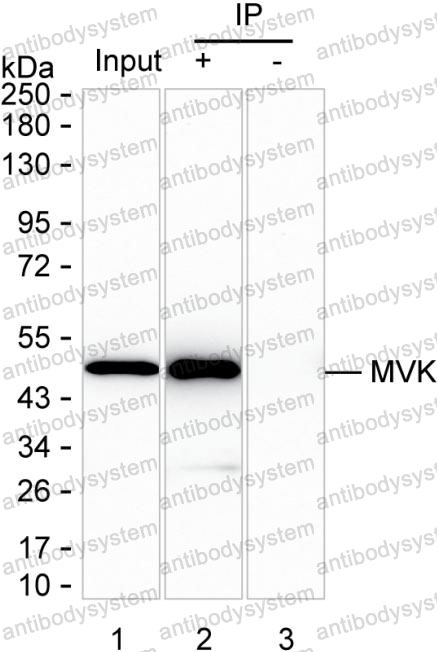 Anti-MVK Antibody (R3Q84)