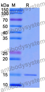 Anti-Human PTH1R Nanobody (SAA1275)