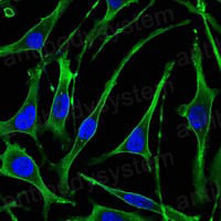 Anti-PTH1R Antibody (R3Q86)