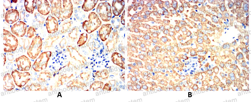 Anti-NF-κB p65 Antibody (R3Q87)