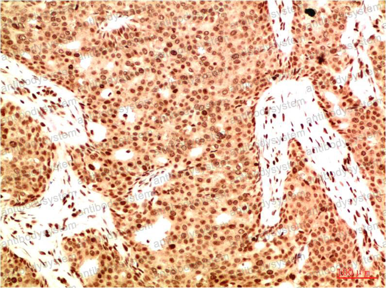 Anti-Acetyl-NF-KB p65 (Lys314/Lys315) Antibody (R3Q89)
