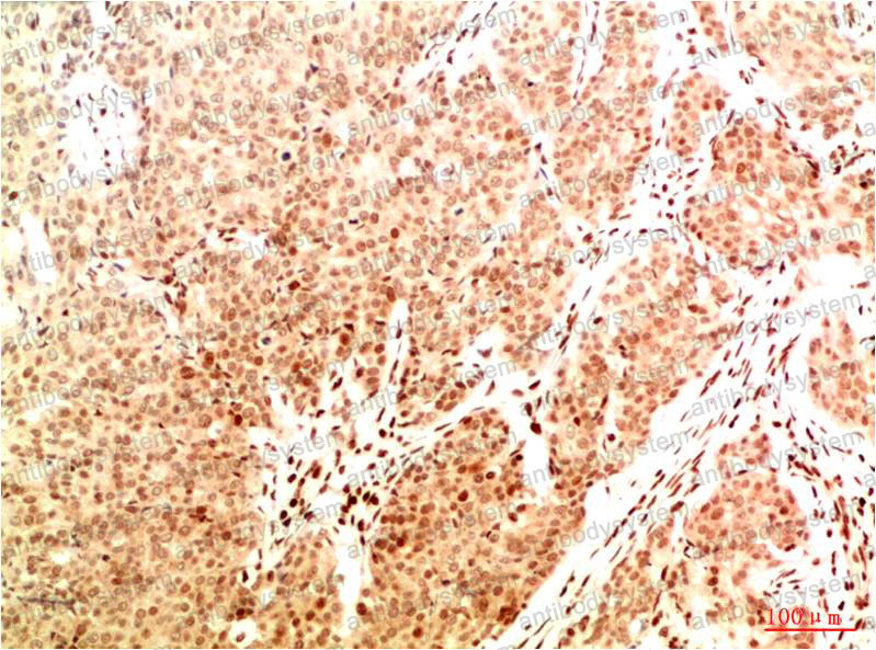 Anti-Acetyl-NF-KB p65 (Lys314/Lys315) Antibody (R3Q88)