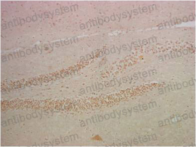 Anti-NF-κB p65 Antibody (R3Q90)