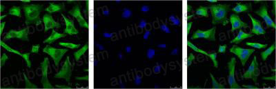Anti-NF-κB p65 Antibody (R3Q91)