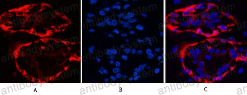 Anti-KRT17 Antibody (R3Q95)