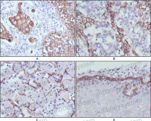 Anti-KRT17 Antibody (R3Q94)