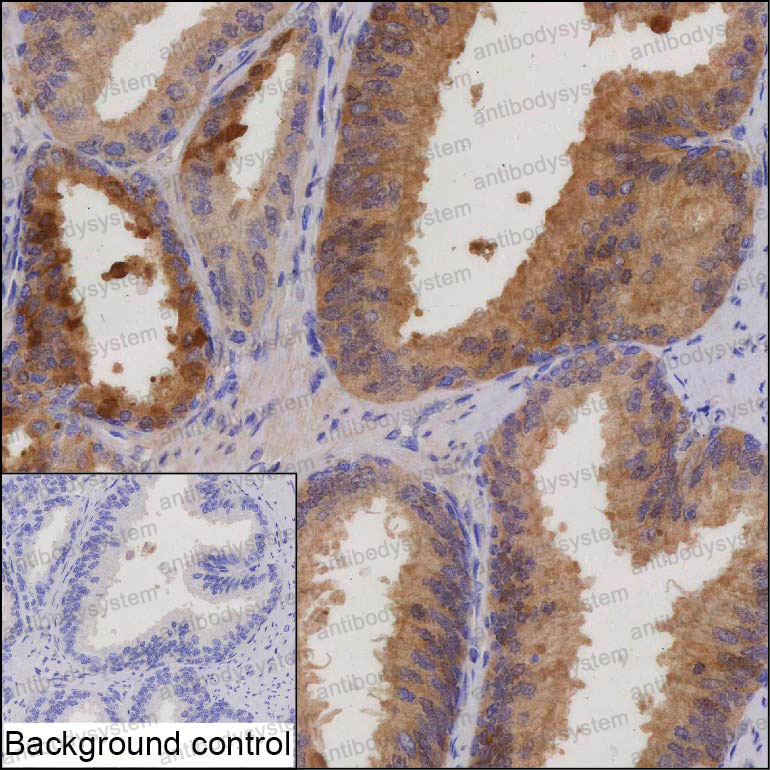 Anti-GLO1 Antibody (R3Q98)