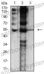 Anti-CHRNE Antibody (R3R04)