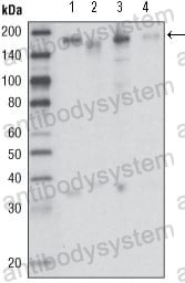 Anti-CD136/MST1R/RON Antibody (R3R07)