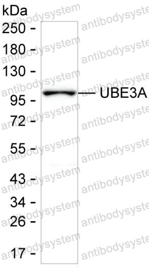 Anti-UBE3A Antibody (R3R09)