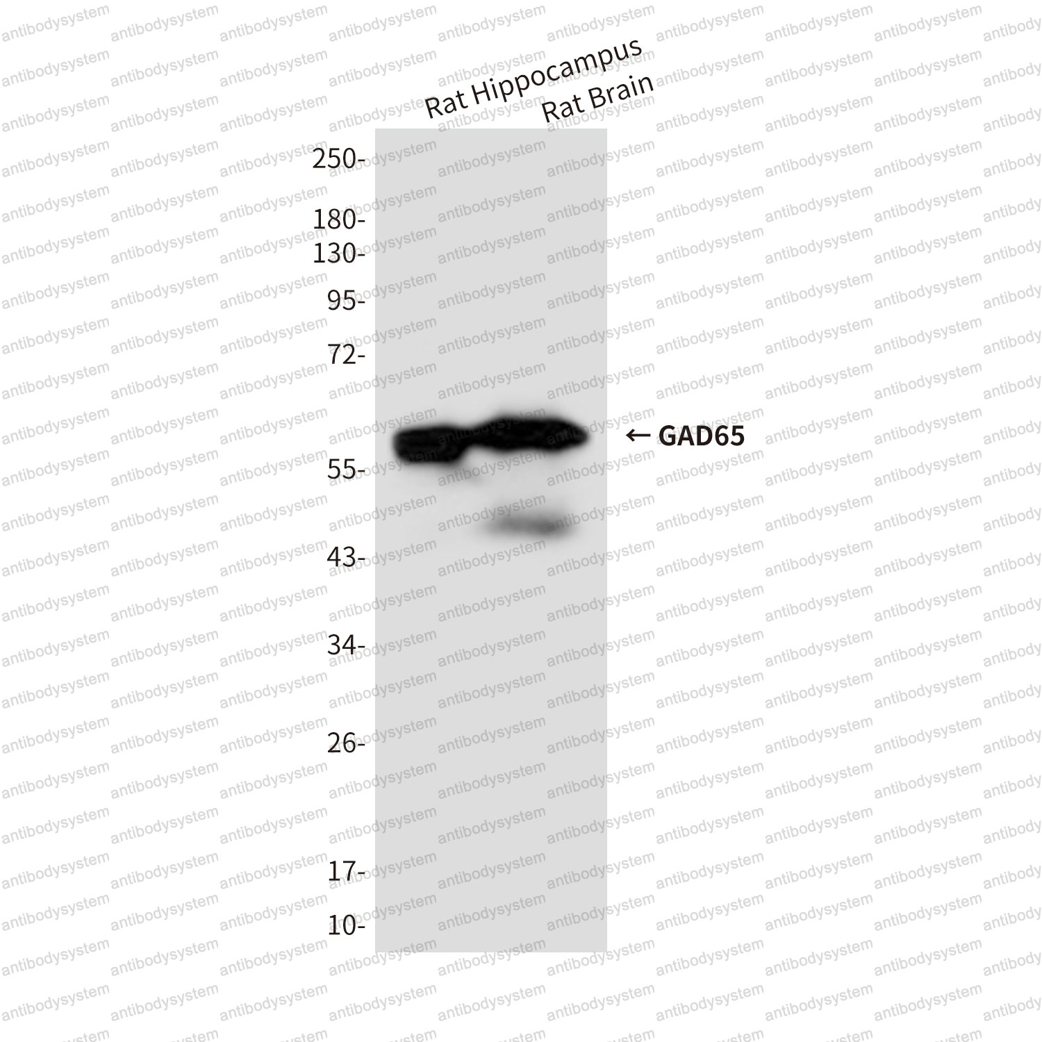 Anti-GAD2/GAD65 Antibody (R3R12)
