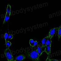 Anti-PTK2 Antibody (R3R13)