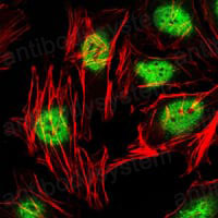 Anti-ZBTB16 Antibody (R3R15)