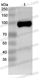 Anti-Human GRIN1/NMDAR1 Antibody (A4B2/Glunomab)