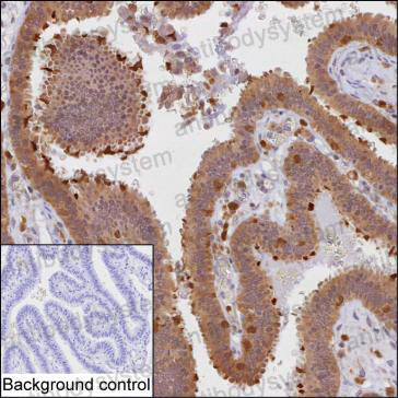 Anti-PRKCD Antibody (R3R16)