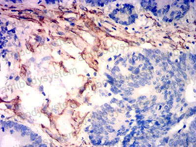 Anti-CALD1 Antibody (R3R18)