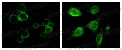 Anti-TYRO3/DTK/SYK Antibody (R3R28)