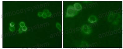Anti-TYRO3/DTK/SYK Antibody (R3R29)