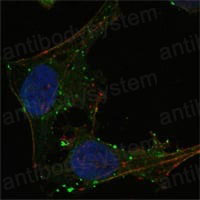 Anti-GABPA Antibody (R3R32)