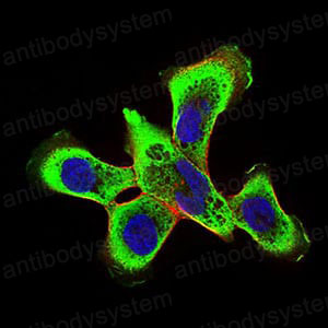 Anti-RING1 Antibody (R3R34)