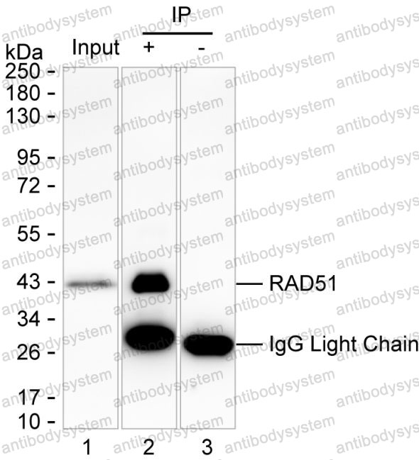 Anti-RAD51 Antibody (R3R35)