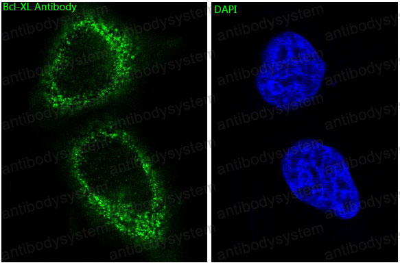 Anti-BCL2L1/Bcl-XL Antibody (R1A24)