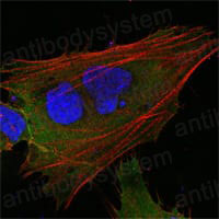 Anti-MCL1 Antibody (R3R56)