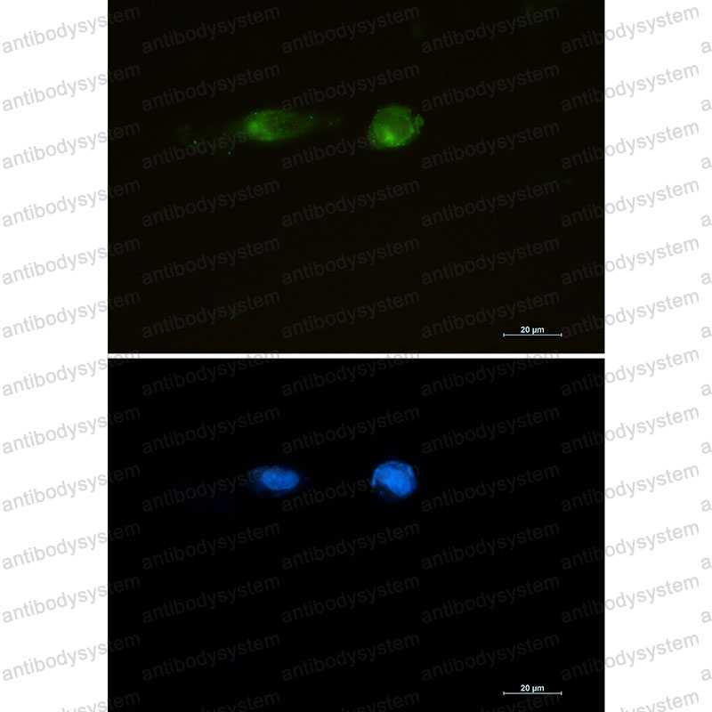 Anti-CD91/LRP1 Antibody (R2D16)