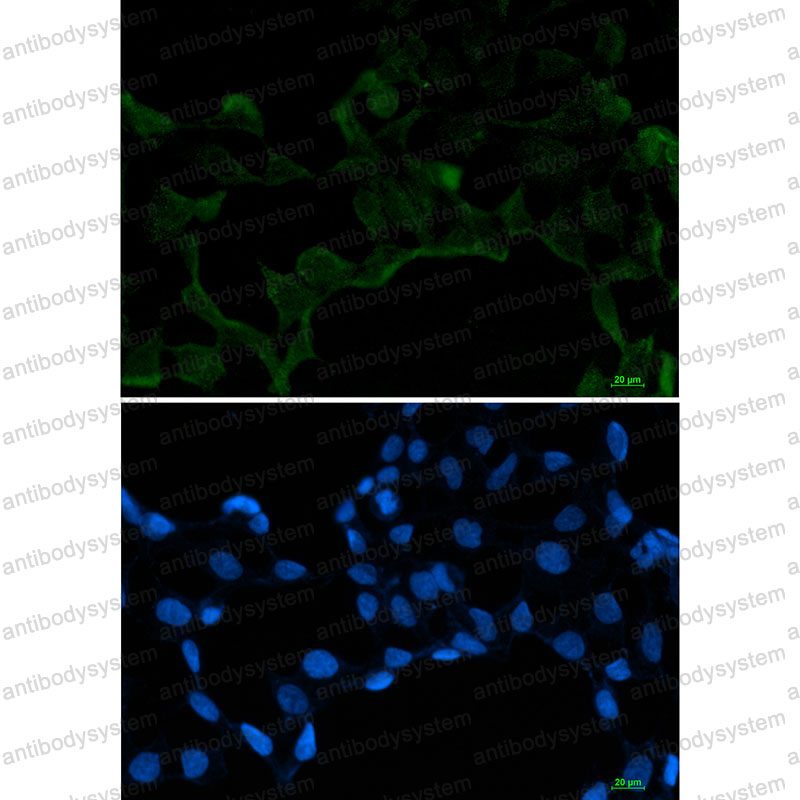 Anti-SRSF1 Antibody (R2D18)