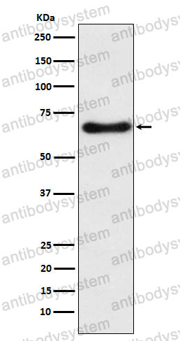 Anti-CYP24A1 Antibody (R2D19)