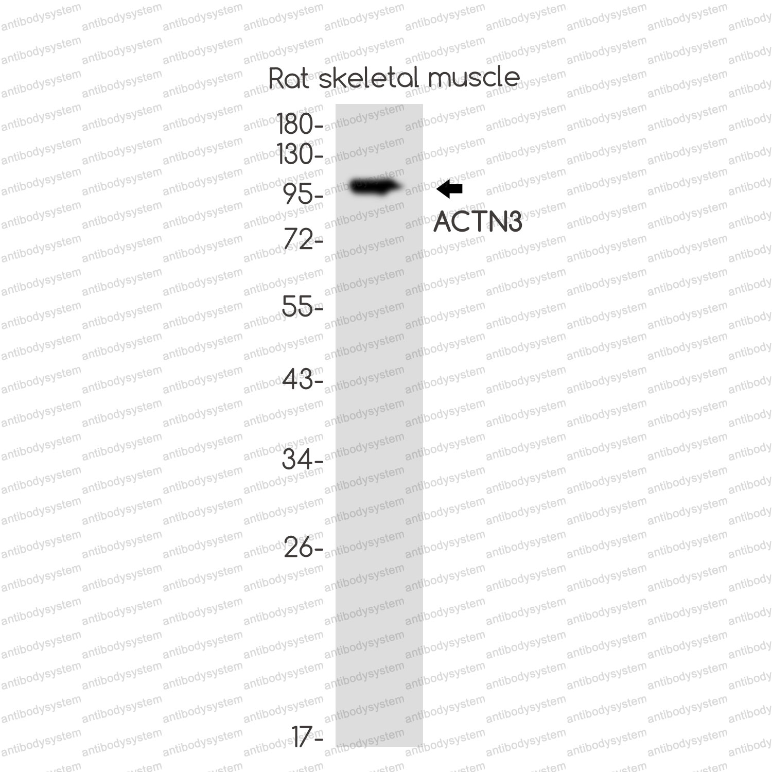 Anti-ACTN3 Antibody (R2D21)