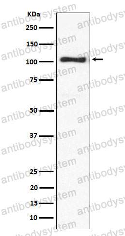 Anti-ACTN3 Antibody (R2D20)