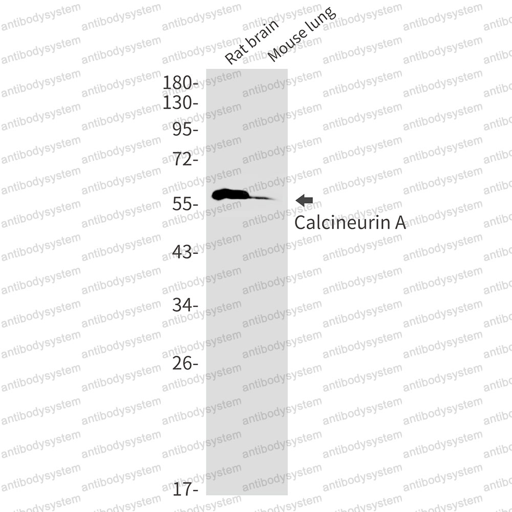 Anti-PPP3CA Antibody (R2D23)