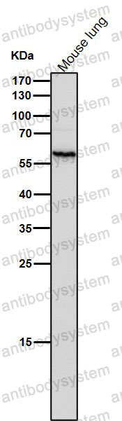Anti-PPP3CA Antibody (R2D22)