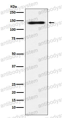 Anti-DHX9 Antibody (R2D24)