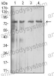 Anti-CDw210b/IL10RB Antibody (R3R64)