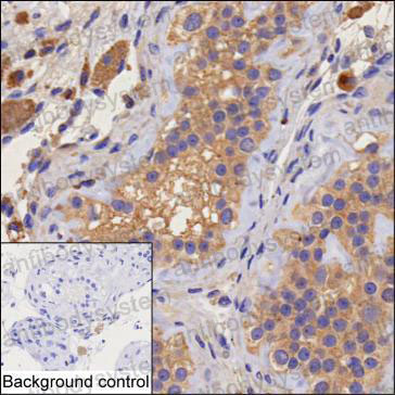 Anti-GOLGA3 Antibody (R3R67)