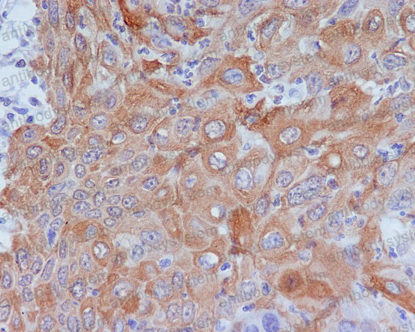 Anti-GM130/GOLGA2 Antibody (R1A62)