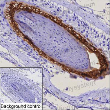 Anti-FABP9 Antibody (R3R78)