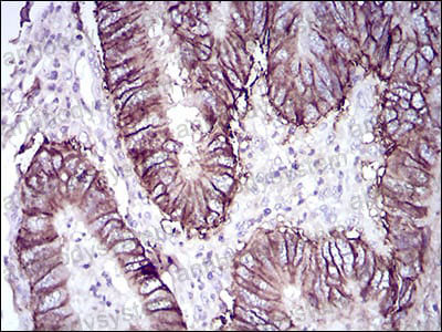Anti-CDH17/Cadherin-17 Antibody (R3R85)