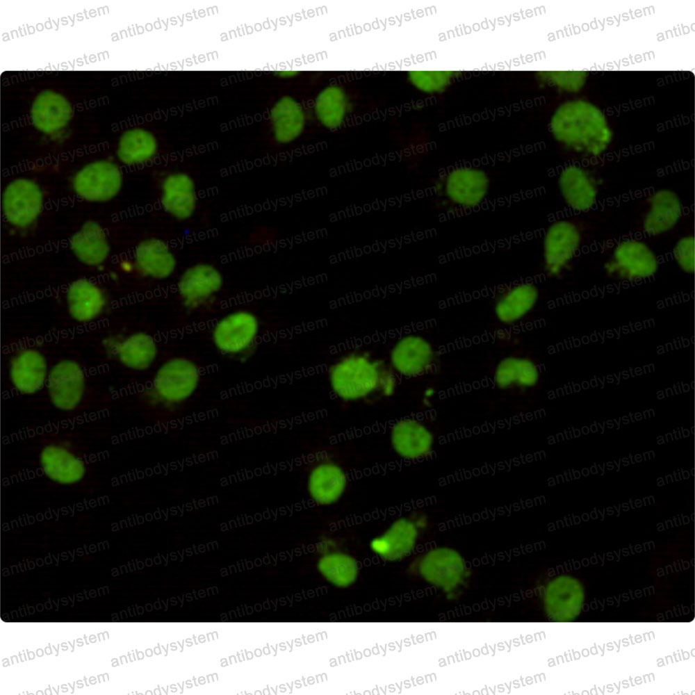 Anti-CHD3 Antibody (R3R88)