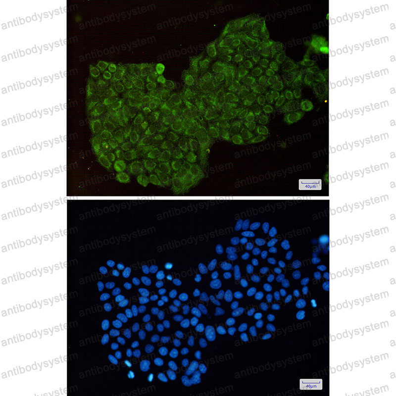 Anti-DPYD Antibody (R2D50)