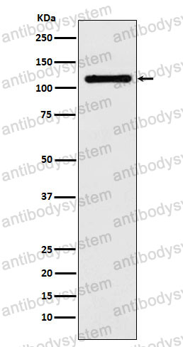 Anti-DPYD Antibody (R2D49)