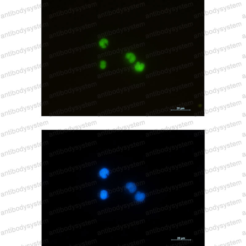 Anti-ILF3 Antibody (R2D54)