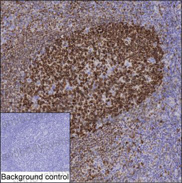 Anti-IRAG2 Antibody (R3R93)