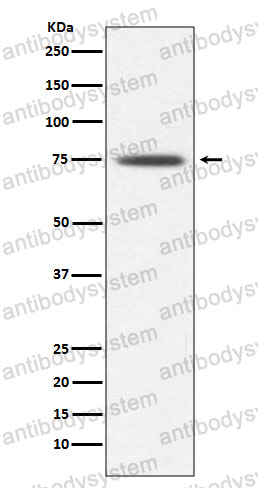 Anti-TRAP1 Antibody (R2D56)