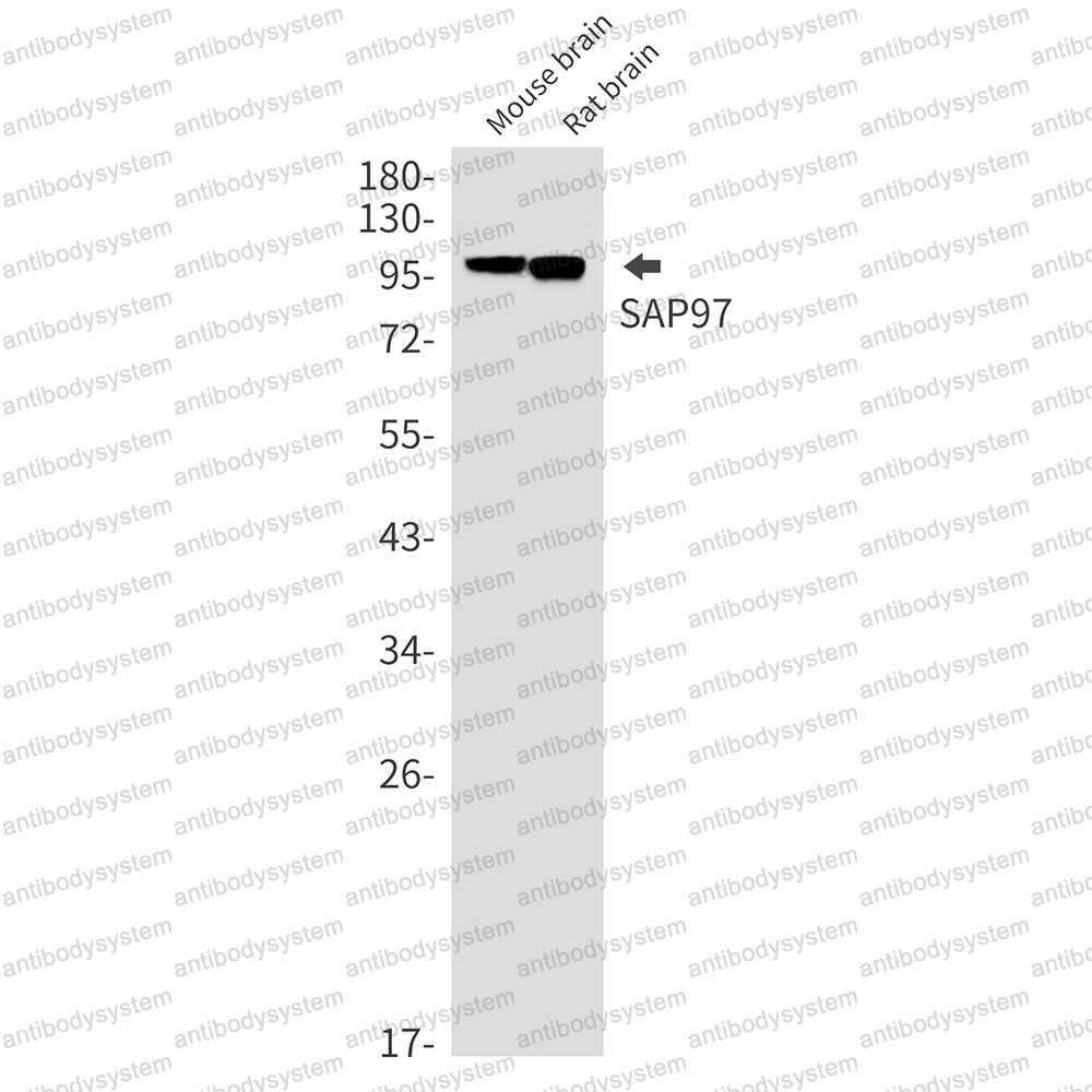Anti-DLG1 Antibody (R2D61)